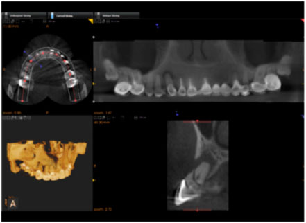 Digital Radiography