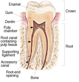 Non-Surgical Endodontic Treatment Illustration