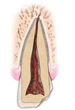 Traumatic Dental Injuries Illustration