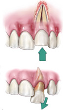 Traumatic Dental Injuries Illustration